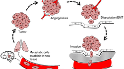 Malignant Neoplasm Adalah Kanker: Pengertian Lengkap